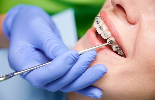 Close,Up,Of,Dentist,Hand,Using,Dental,Forceps,While,Putting